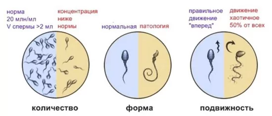Спермограмма в Москве цена